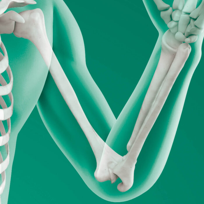 Daonsa Implantes