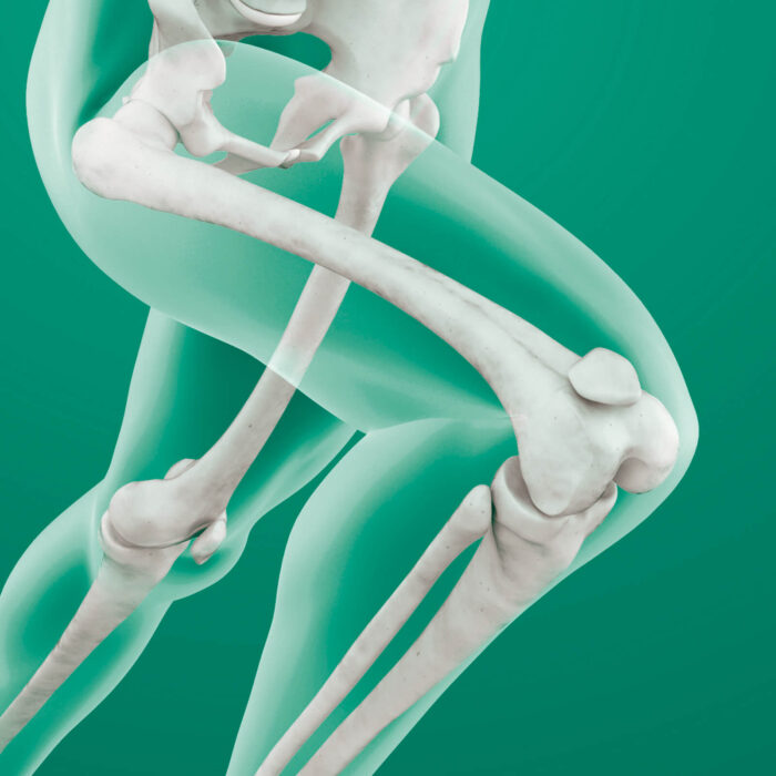 Daonsa Implantes