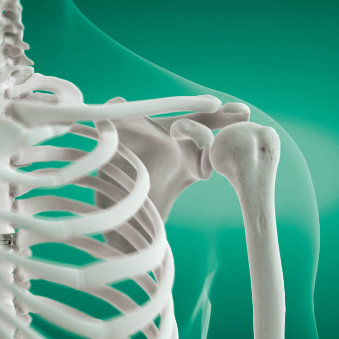 Daonsa Implantes
