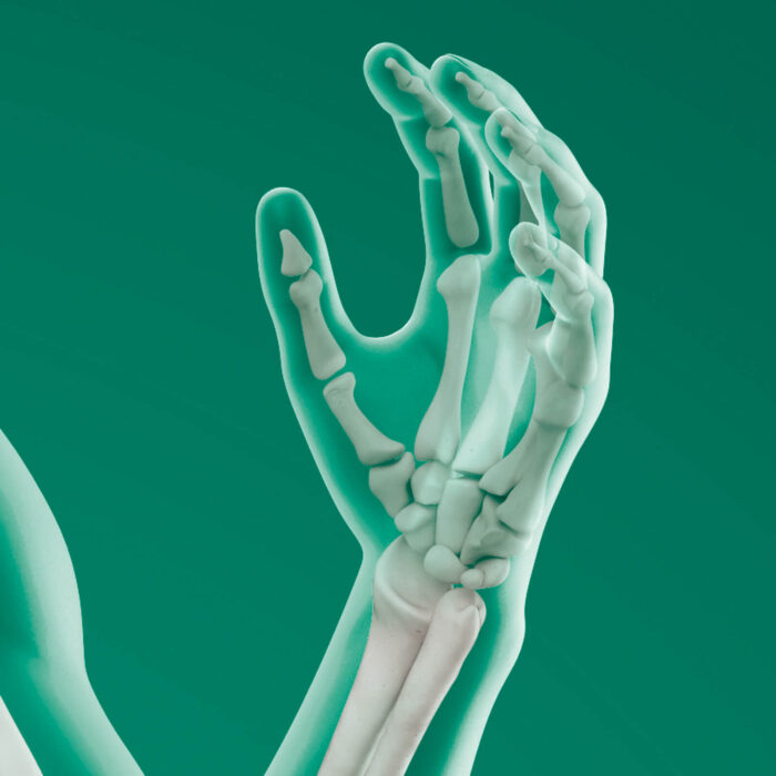 Daonsa Implantes