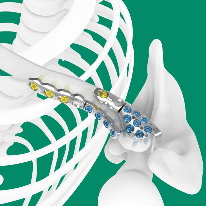 Daonsa Implantes